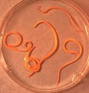 Az ember aszcarid parazitái