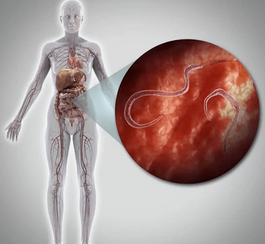 Paraziták az emberi testben