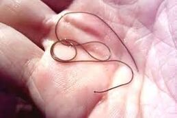 Parazita a tenyerében