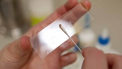 Calais elemzés a paraziták azonosítására