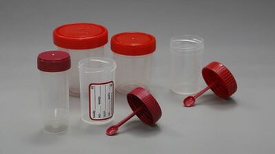 Hogyan készüljünk fel a paraziták tesztelésére