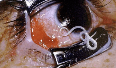 A paraziták típusai az emberi testben