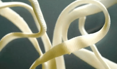 Hogyan lehet eltávolítani a parazitákat az emberi testből