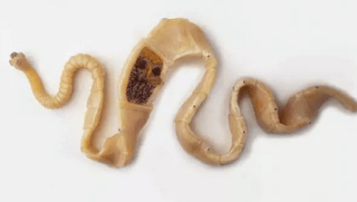 Hogyan lehet felfedezni a paraziták jelenlétét a testben